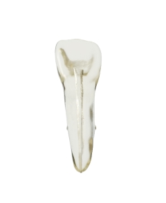 EndoPrep® 11 Numara Şeffaf Diş