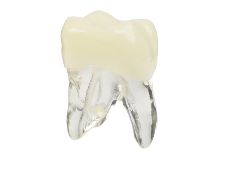 Endodonti