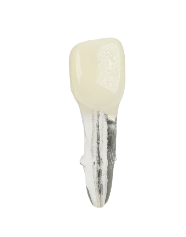 Endodonti