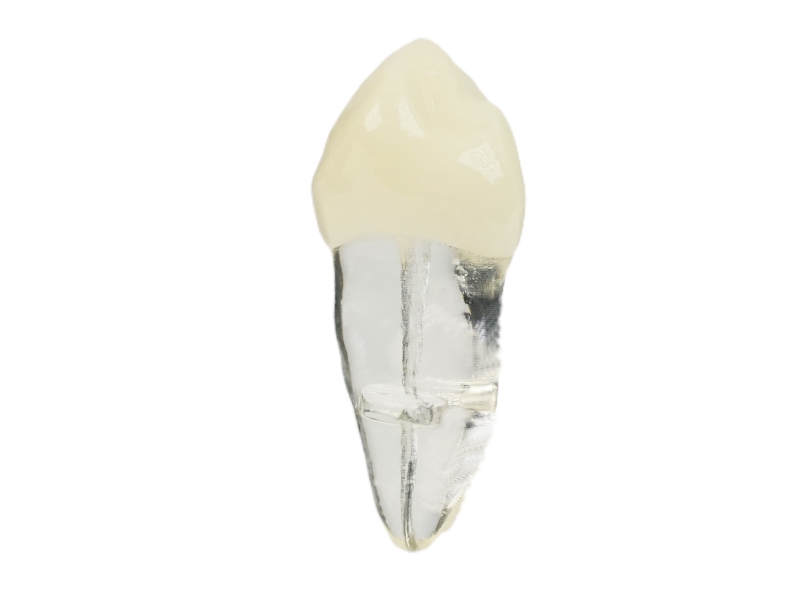 Endodonti