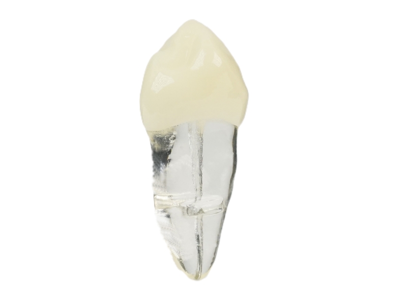 Endodonti