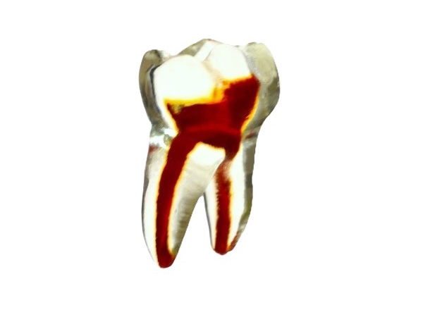 PedoPrep® 85 Numara Şeffaf Diş