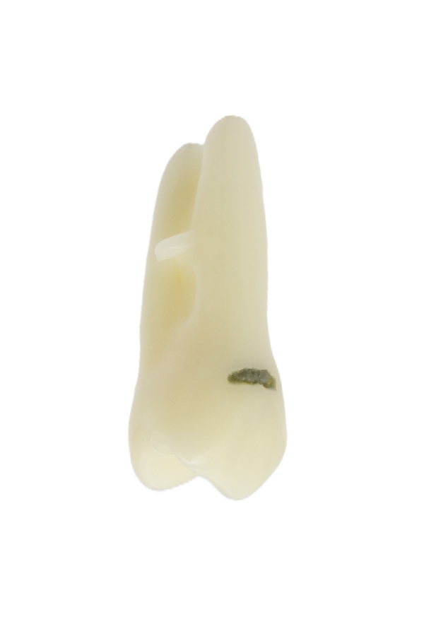 RestoPrep® 14 Numara Diş