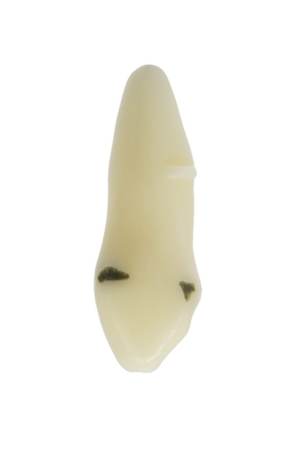 RestoPrep® 23 Numara Diş