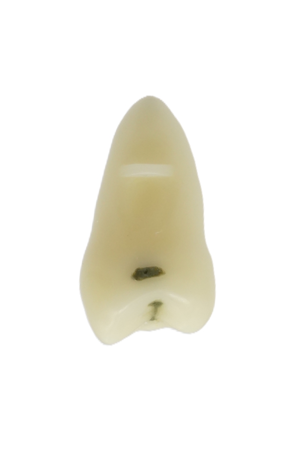 RestoPrep® 25 Numara Diş