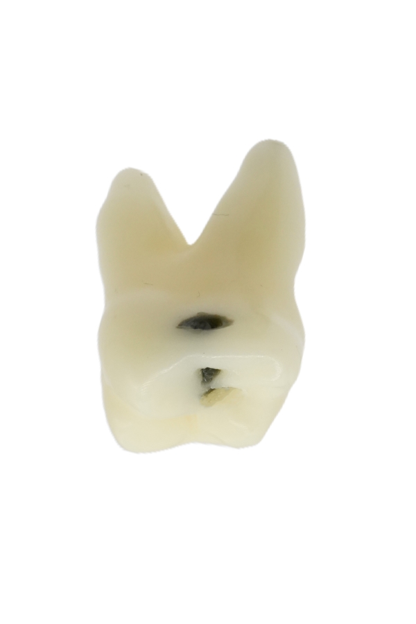 RestoPrep® 26 Numara Diş