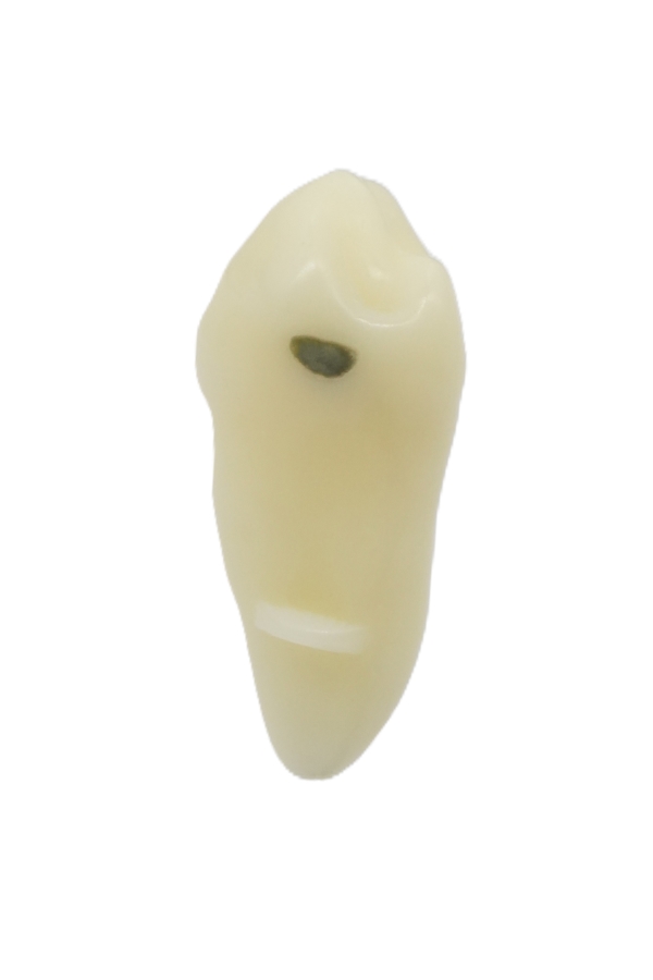 RestoPrep® 34 Numara Diş