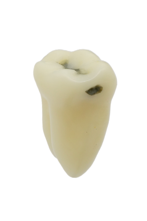 RestoPrep® 36 Numara Diş