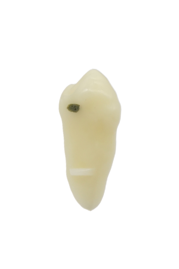 RestoPrep® 44 Numara Diş