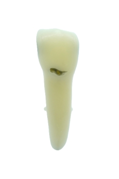 RestoPrep® 11 Numara Diş