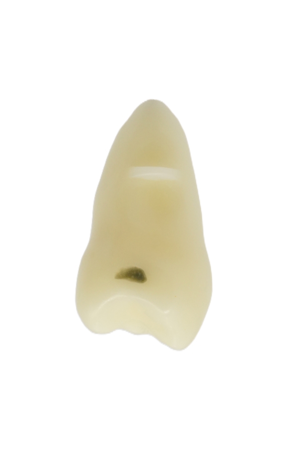 RestoPrep® 15 Numara Diş